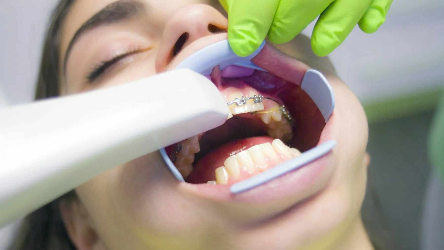 Curso de Ortodontia na Odonto & Med