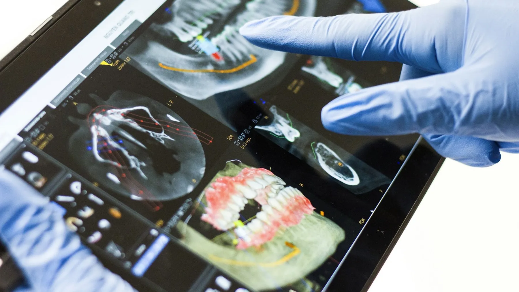 Curso de Implantodontia e Periodontia na Odonto & Med