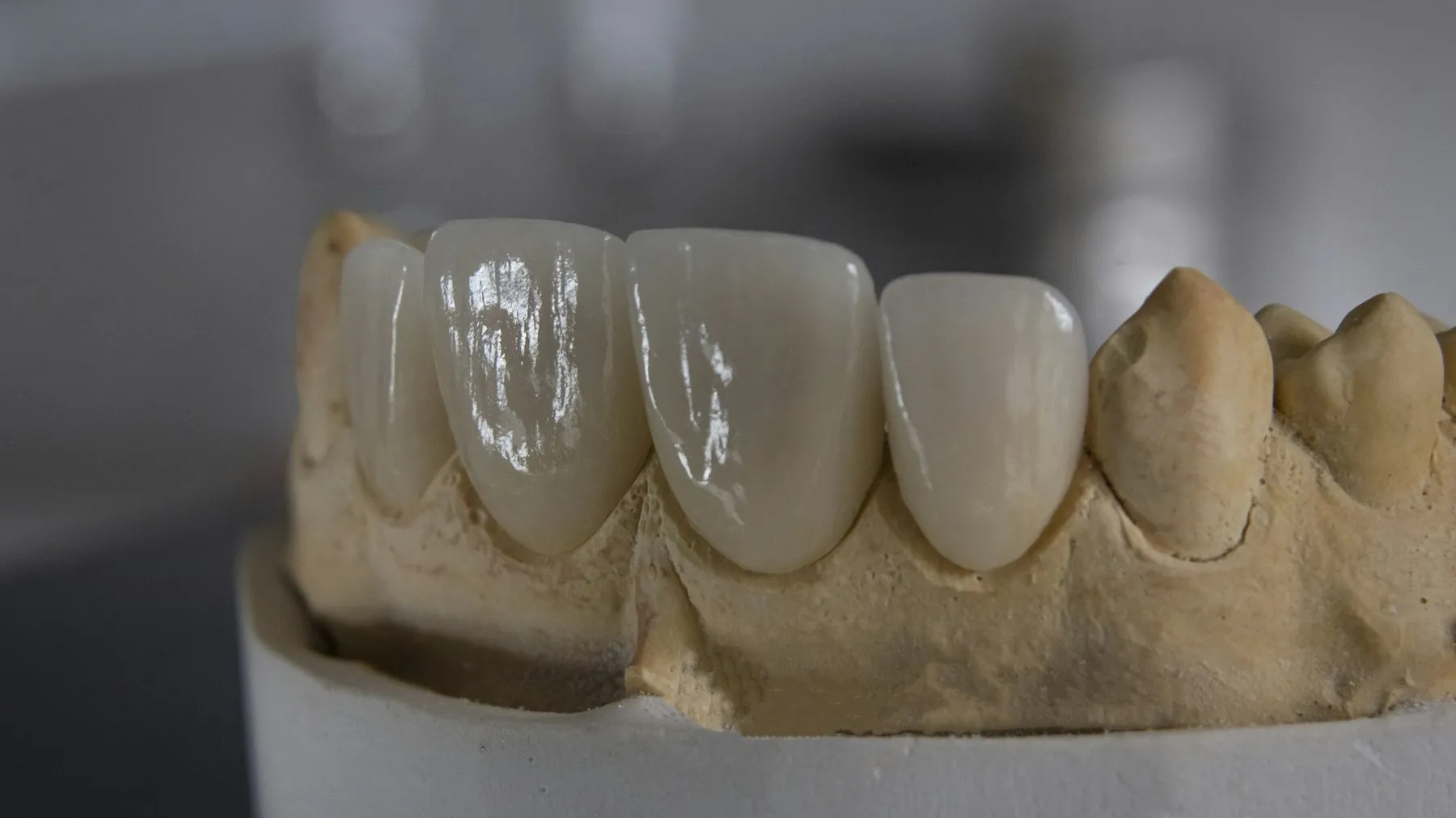 Curso de Prótese Dentária na Odonto & Med